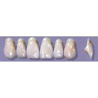 MYERSON ANTERIORS #A13/E (1x6 CARD) Card