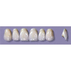 MYERSON ANTERIORS #A72/69 (1x6CARD) Card